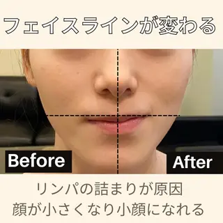 肩首こり×痩身×浄化 🌿リンパエステのエステ・リラクイメージ