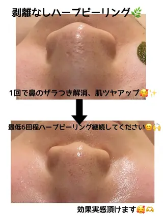 NHerb【エヌハーブ】所属・横田 汐里のエステ・リラクイメージ