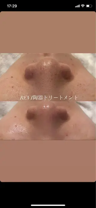 小顔&デコルテ Spa　“koti”のエステ・リラクイメージ