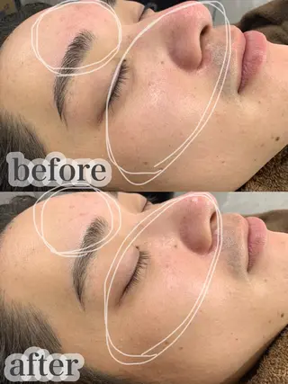 LAGRECE 大阪梅田店のエステ・リラクイメージ