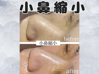 Beauty salon ハピー所属・大人女性のための 肌管理サロン　ハピーのエステ・リラクイメージ