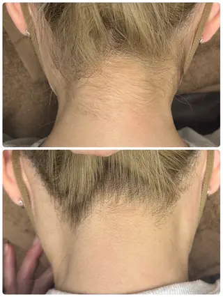 ◯△□所属・最新美肌脱毛 韓国水光肌🫧のその他イメージ