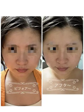 フェイシャルエステ アンソン・ドゥのエステ・リラクイメージ