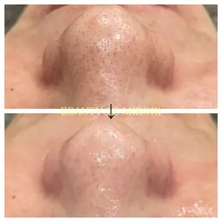 ビューティー ミロワールのエステ・リラクイメージ