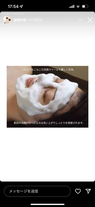 ニキビ跡改善専門🔥 医療にはできない改善のエステ・リラクイメージ