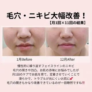 PRETTIEST SHINE所属・フェイシャル/ボディ /ブライダル山田浩子のエステ・リラクイメージ