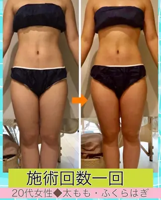 ロング カラー パーマ ヘアアレンジ メンズ キッズ ネイル マツエク・マツパ ‍痩身＆ボディ 結果出し🌟丹野のエステ・リラクイメージ