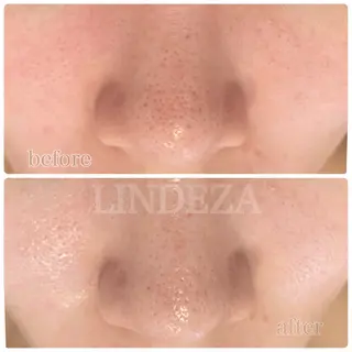 private salon 𝐋𝐈𝐍𝐃𝐄𝐙𝐀所属・LINDEZA Ayaのエステ・リラクイメージ