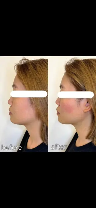 小顔矯正&美容整体 整え屋REDオーナーのエステ・リラクイメージ