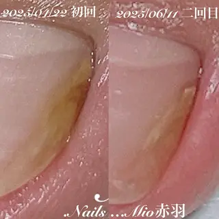 ネイル .Nails Mio 赤羽西ネイルサロンのネイルデザイン