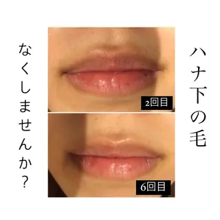 美肌脱毛専門サロン Dione栄店のエステ・リラクイメージ