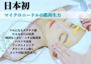 beauty & health salon Chou chou所属・ニキビ・毛穴🌿肌を 育てるララピール✨のエステ・リラクイメージ