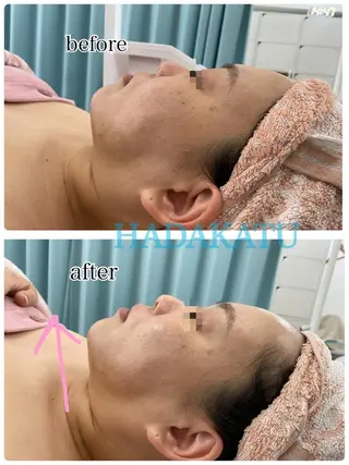 総合エステサロン 肌活のエステ・リラクイメージ