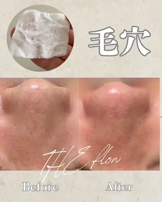 シミ毛穴ケア EsteAのエステ・リラクイメージ