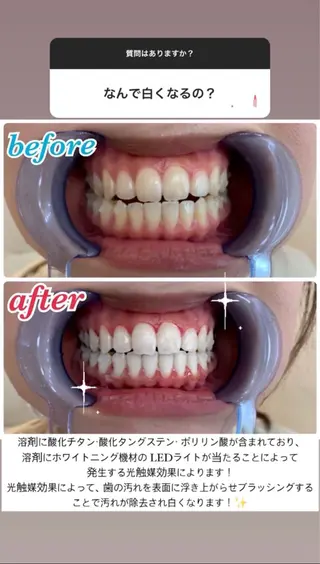 セルフホワイトニング エクシア大曽根店のその他イメージ