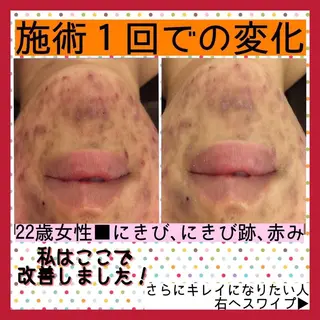 ミディアム カラー パーマ ヘアアレンジ メンズ キッズ ネイル マツエク・マツパ アイブロウ ニキビ・肌質改善専門 ♡人生が変わるサロンのエステ・リラクイメージ