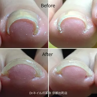 ネイル ドクターネイル爪革命 京都出町店 / 北尾のネイルデザイン