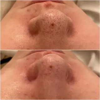 ララ/ハーブ メゾンリュバンのエステ・リラクイメージ