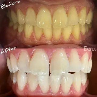 メンズ キッズ ホワイトニングサロン Ecru所属・ホワイトニングサロン Ecru エクリュのその他イメージ