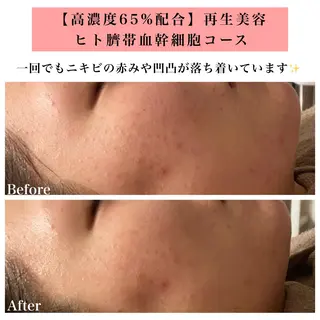 Bellesthe (ベルエステ)のエステ・リラクイメージ