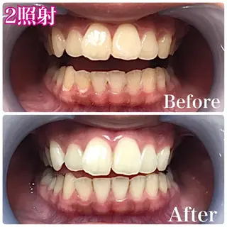 LOVE ホワイトニング渋谷のその他イメージ