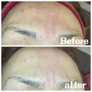 肌質改善サロン facialmoonのエステ・リラクイメージ