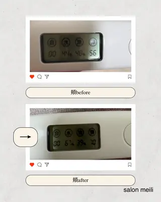 リラク&よもぎ蒸し 耳つぼ♡Mizukiのエステ・リラクイメージ