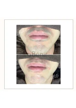 脱毛/美肌【皮膚科看 護師経営】ラベニールのエステ・リラクイメージ