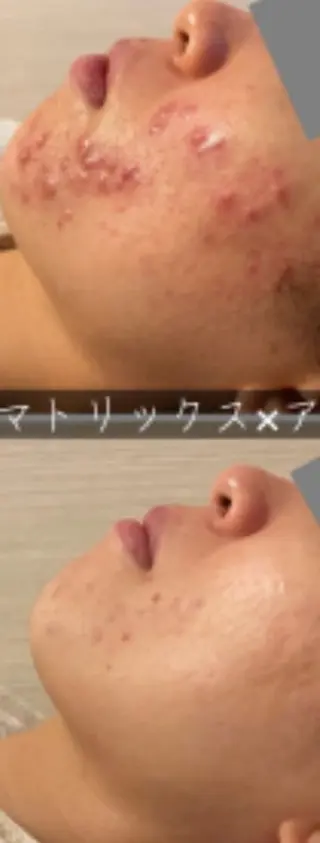 En. facial &body【エンドット】所属・En. ENAのエステ・リラクイメージ