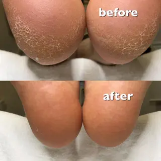 ENSIA エンシアのネイルデザイン