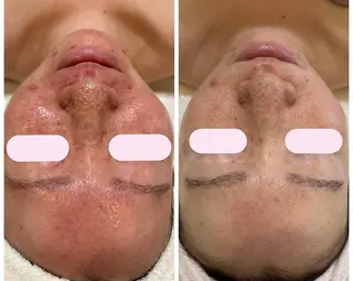 【新宿】 PulBeauteのエステ・リラクイメージ