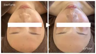 1st｜フェイシャル エステ専門店のエステ・リラクイメージ