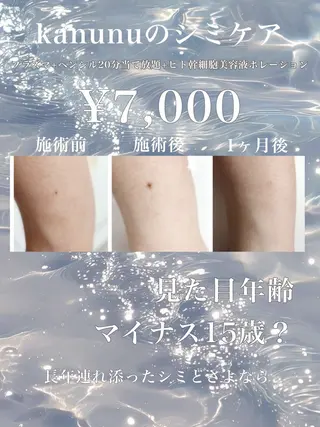 Kanunu所属・鶴橋エステ kanunuのエステ・リラクイメージ