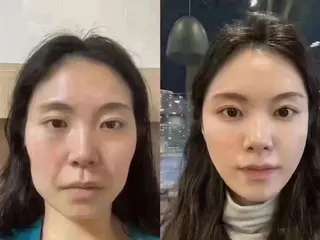 ネイル aliaハイフ&水光ジェットサロン所属・aliaハーブ水光店 エステティシャン募集のエステ・リラクイメージ