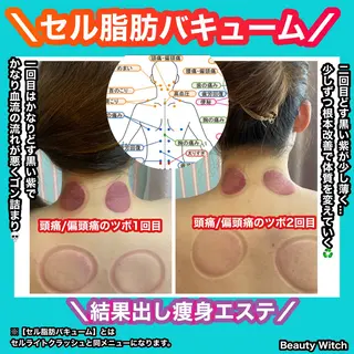 痩身/脱毛/ネイル HARUKAのエステ・リラクイメージ