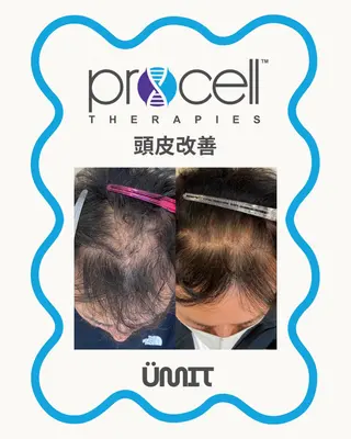 メンズ Ümit（ユミト） プロセルセラピーズのネイルデザイン