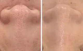 ..Belire.Revi所属・ベリールルヴィ ベリールルヴィのエステ・リラクイメージ