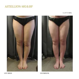 Sylphya (シルフィア)のエステ・リラクイメージ