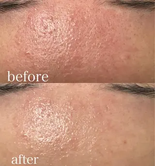 Beauty   Salon  Adiy所属・Adiy ikumiのエステ・リラクイメージ