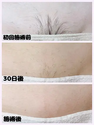 sugaring salon Malo所属・シュガーリングサロン Maloのエステ・リラクイメージ