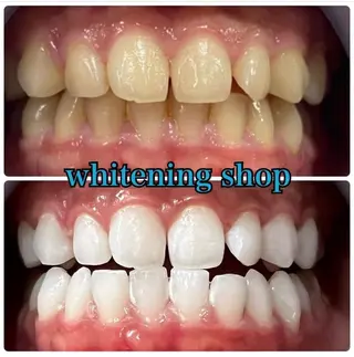 ホワイトニング ショップ吉祥寺店のエステ・リラクイメージ