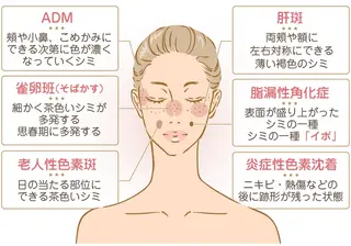 Porte beauteオーナーのエステ・リラクイメージ