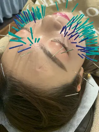 表参道鍼灸院K 美容鍼🔮ララピールのエステ・リラクイメージ