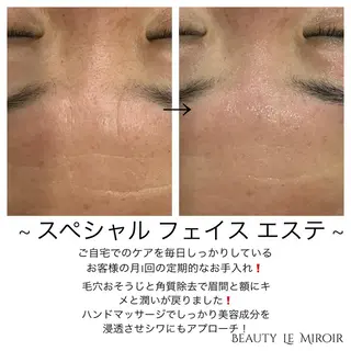 ビューティー ミロワールのエステ・リラクイメージ