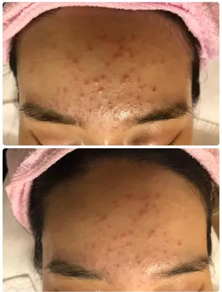 肌育成サロンcoco.A(ココアンジュ)所属・美肌コンサルタント/ 小西晴日のエステ・リラクイメージ