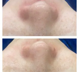 RE:moom リムーム/脱毛エステのエステ・リラクイメージ