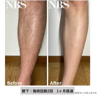 メンズ トータルビューティー サロン　Lisseの眉毛・アイブロウイメージ