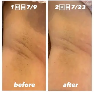 eclatie（エクラティエ）所属・横井 愛奈のエステ・リラクイメージ