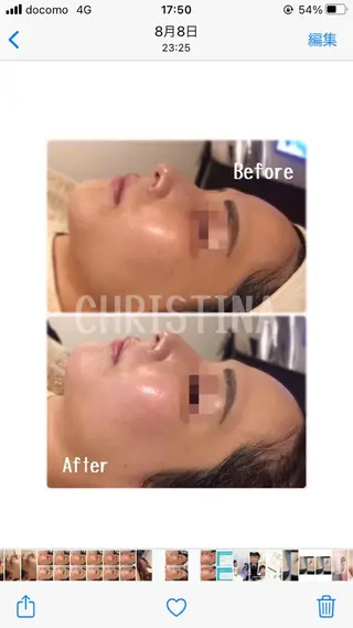 肌質改善サロンChouChou所属・肌質改善サロン chouchouのエステ・リラクイメージ