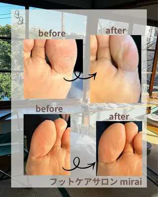 フットケアサロン miraiのその他イメージ